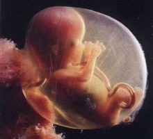Stotine žena godišnje abortira zbog “pogrešnog” pola