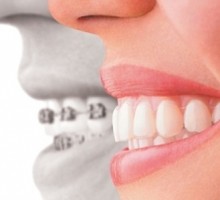 Šta možete očekivati od prvog ortodontskog pregleda