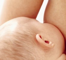 Dojenje i terapija za urtikariju
