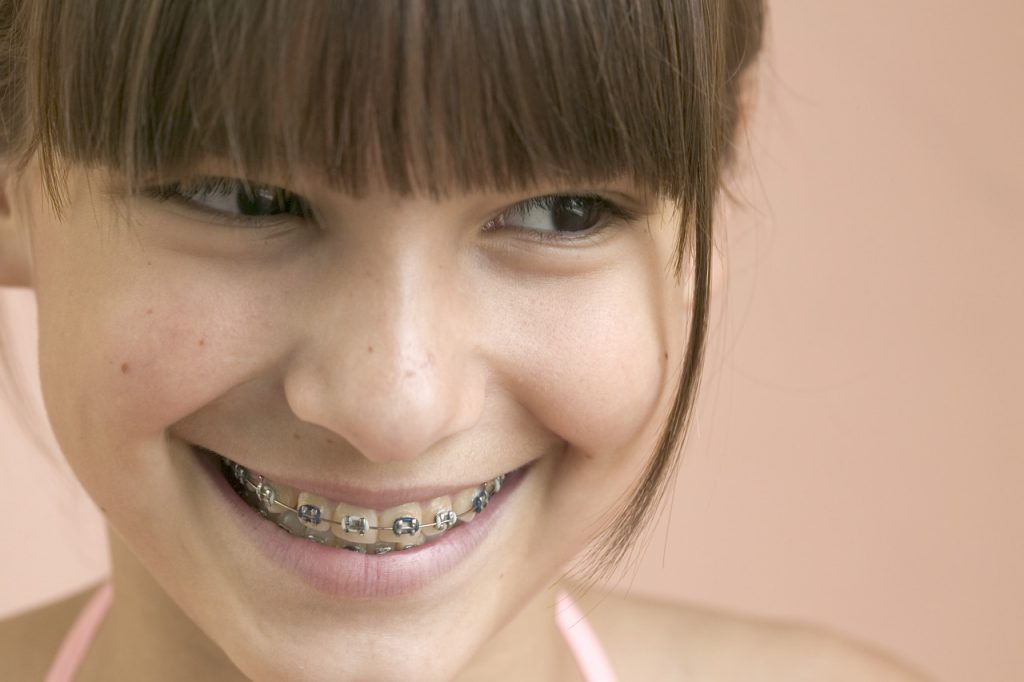 Smiling Girl With Braces --- Image by © Royalty-Free/Corbis