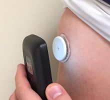 Roditelji djece sa dijabetesom senzore mogu nabaviti putem poštanskih pošiljki