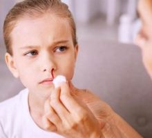 Kako pravilno zaustaviti krvarenje iz nosa kod djece