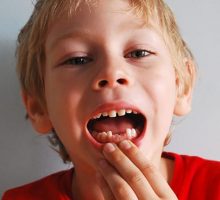 Izbijeni zub moguće je vratiti u ležište ako se reaguje na vrijeme
