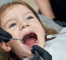 Kakva su vaša iskustva sa stomatološkim uslugama za djecu